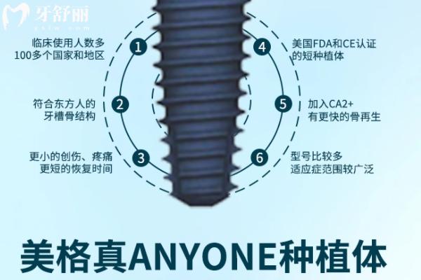 美格真植体是韩国品牌种植牙