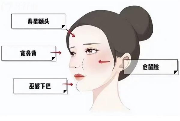 李方奇馒化修复怎么样?面部减容技术可靠价格2w起在北京奥尔贝德坐诊