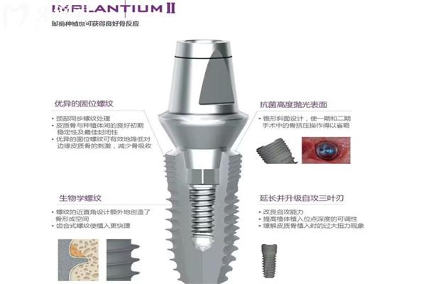 解析目前常用种植体的品牌:登腾种植牙是什么档次的?价格为什么这么便宜?
