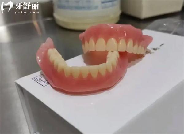 吸附性义齿真的那么好吗?和种植牙对比哪个好?分析优缺点及价格表