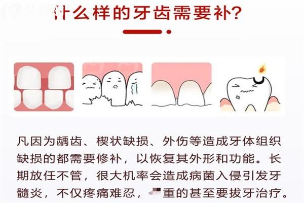 补牙贵还是根管治疗贵 怎么判断牙齿需要做根管治疗或是修补呢