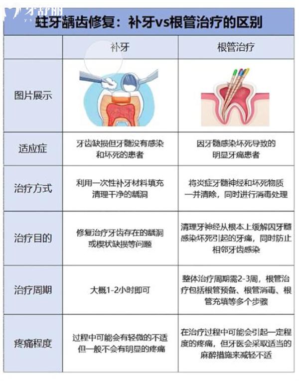 补牙贵还是根管治疗贵 怎么判断牙齿需要做根管治疗或是修补呢
