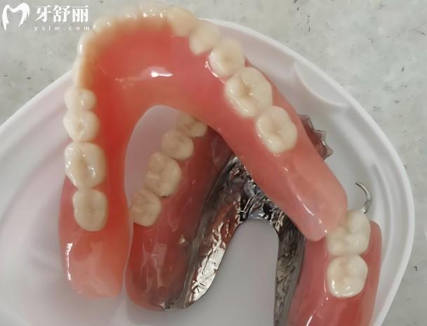 上海全口假牙多少钱一副