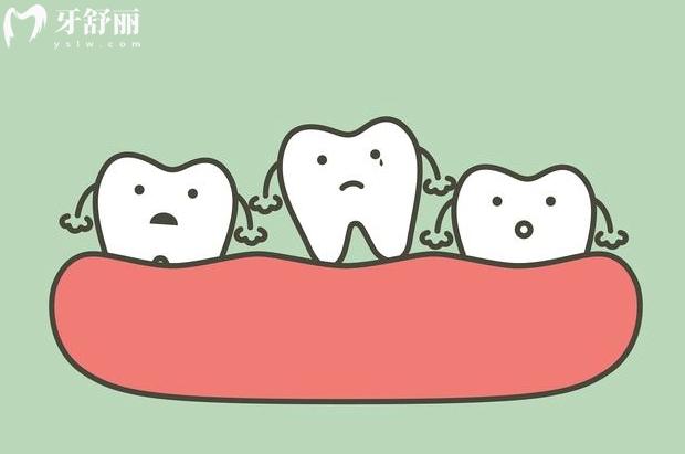 牙龈萎缩牙根露出怎样治疗
