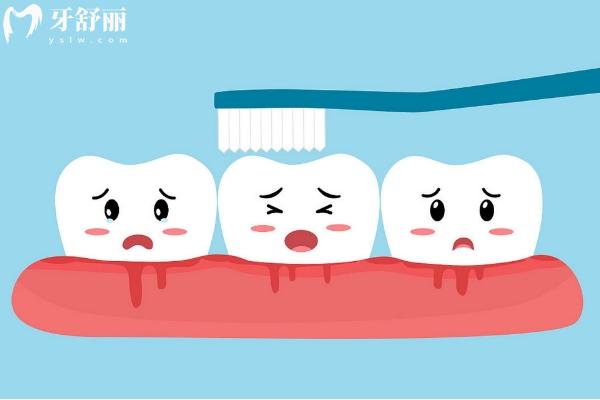 牙龈经常出血是咋回事？口腔卫生没做好/牙周病等原因点击查看预防