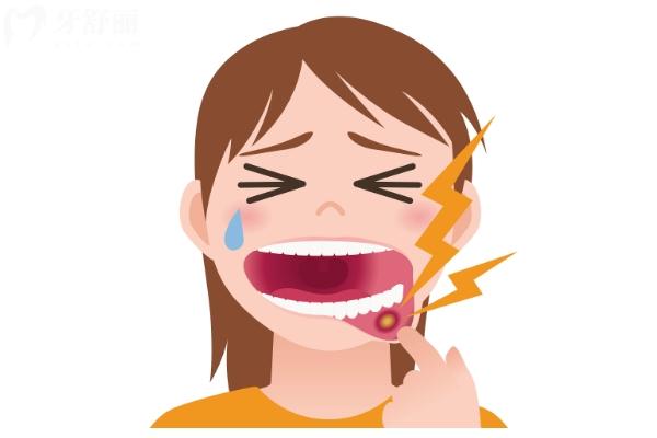 口腔溃疡反复来袭？教你快速治疗和预防的方法！