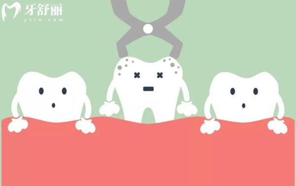 拔牙前必知：高血压/糖尿病患者如何准备？术前检查清单大公开