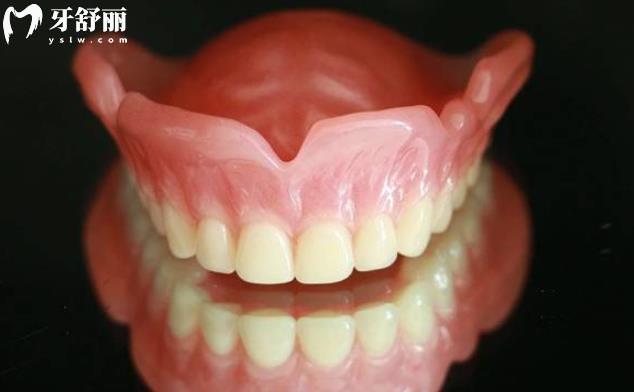 解析吸附性义齿的优缺点,和普通义齿有啥差别及价格 解析吸附性义齿的优缺点,和普通义齿有啥差别及价格