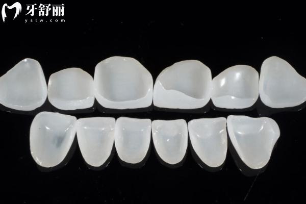 牙缝太大太尴尬？一文读懂靠谱快捷的补救方法！