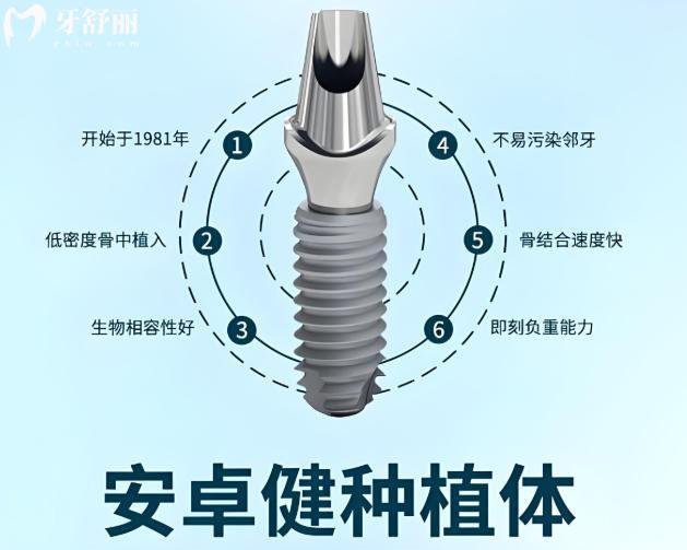 安卓健种植体型号有哪些?分析常用的三种型号的区别/价格/使用寿命