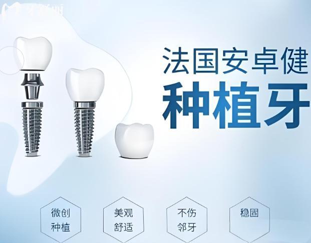 安卓健种植体型号有哪些?分析常用的三种型号的区别/价格/使用寿命