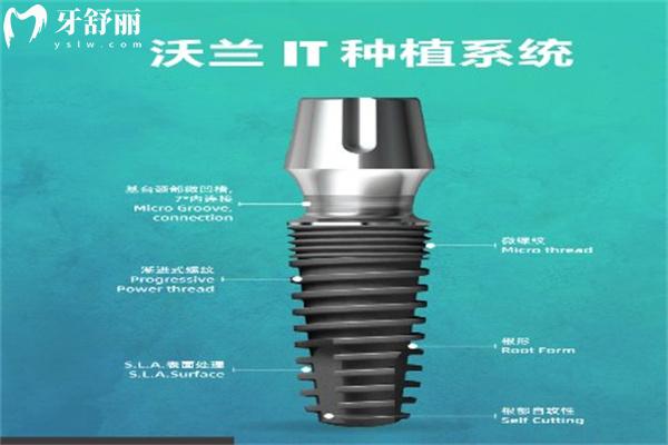韩国种植牙哪个牌子的好?一文解锁韩国十大种植牙品牌排行榜性能及价格