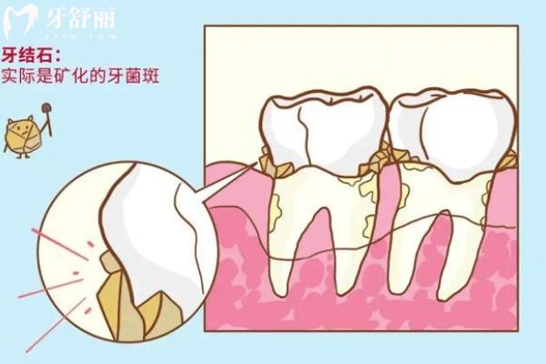 普宁牙科哪个医院好？