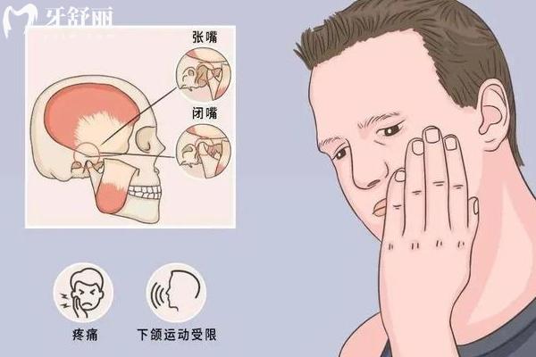 颞颌关节紊乱是什么原因造成的