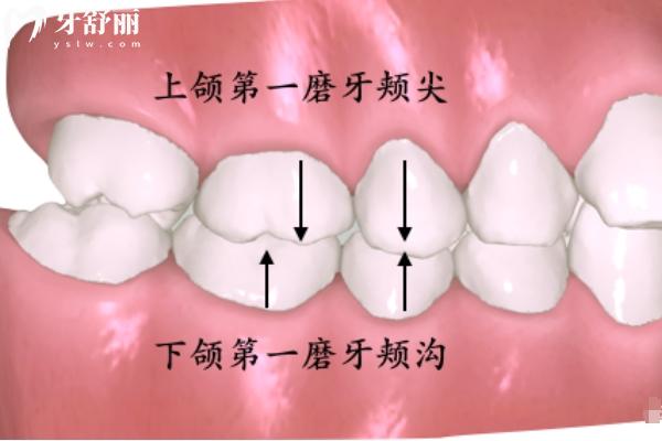 颞颌关节紊乱是什么原因造成的