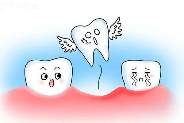 老年人牙齿松动怎么办？明确病因及时治疗很重要