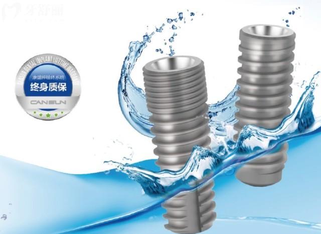 上海浦东种植牙多少钱一颗?【2025价格1980-2W不等】,附技术好的牙科医院