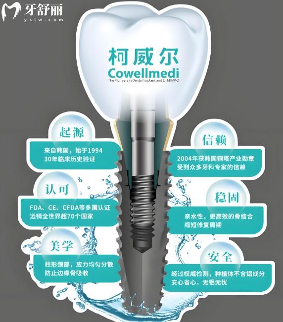 韩国柯威尔植体的优缺点是什么?多少钱一颗?3分钟带你了解