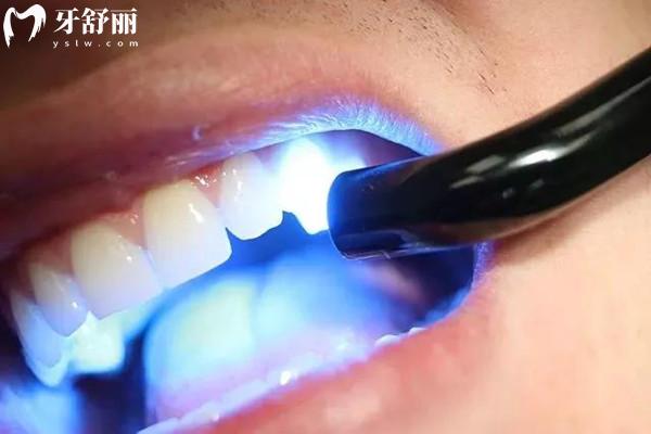 绵阳牙科医院收费价格表
