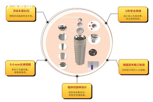 成都口腔医院种植牙价格表