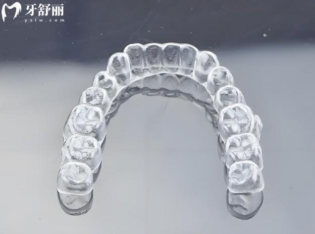 分析可丽尔隐形矫正优缺点有哪些?还有牙套收费多少钱,大家别错过
