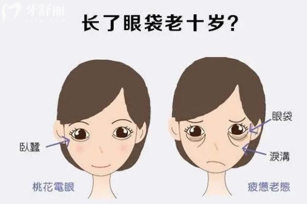 郑州十大双眼皮医生排行榜:口碑前十医生做双眼皮技术可靠自然精致