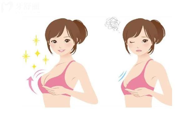 沈阳假体隆胸手术哪家医院好