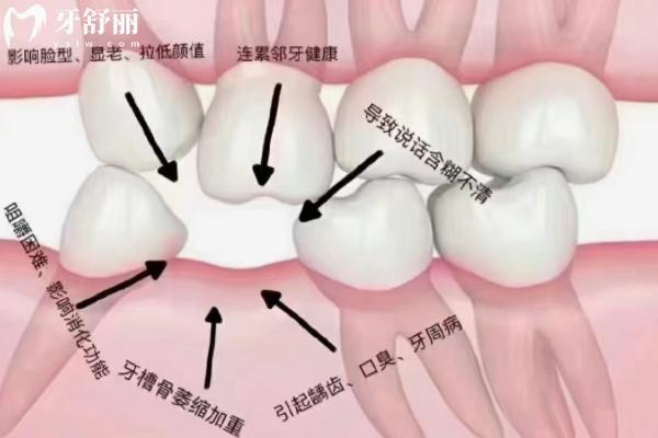 穿翼板种植牙技术成熟吗