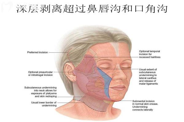 谢宏彬怎么挂号?拉皮医生谢宏彬预约挂号/电话号码/坐诊信息/拉皮价格一文分享