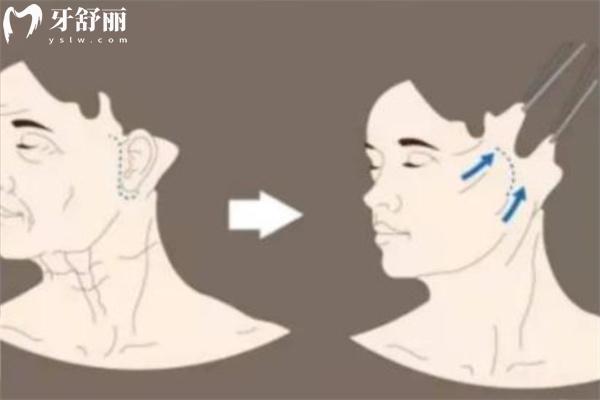 谢宏彬怎么挂号?拉皮医生谢宏彬预约挂号/电话号码/坐诊信息/拉皮价格一文分享