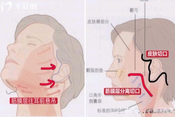 谢宏彬怎么挂号?拉皮医生谢宏彬预约挂号/电话号码/坐诊信息/拉皮价格一文分享