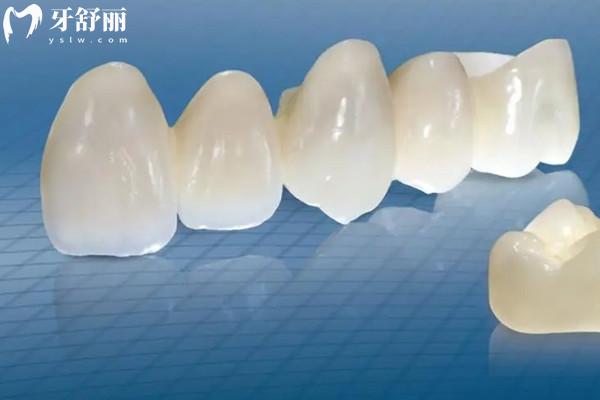国产全瓷牙和进口全瓷牙哪个好
