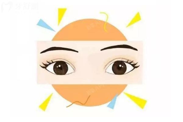 韩国双眼皮修复要多少钱？2026 年价格梯度 + 隐性成本全拆解