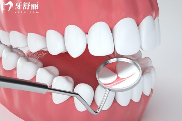 深圳美奥口腔吸附性义齿多少钱