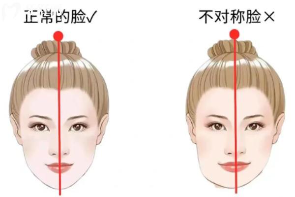 大小脸矫正需要多少钱