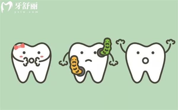 补牙时使用哪种材质坚固?推荐6种常用的补牙材料,科学选材更安心