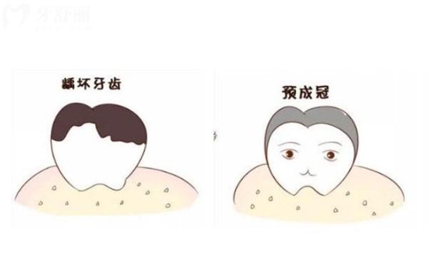 常州口腔医院价格表2026版:种植牙/矫正/补牙/根管收费不贵及技术好的牙科推荐 常州口腔医院价格表2026版:种植牙/矫正/补牙/根管收费不贵及技术好的牙科推荐