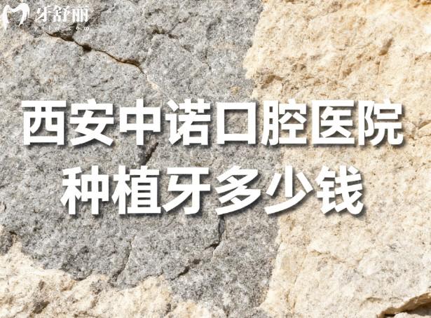 西安中诺口腔医院种植牙多少钱 西安中诺口腔医院种植牙多少钱