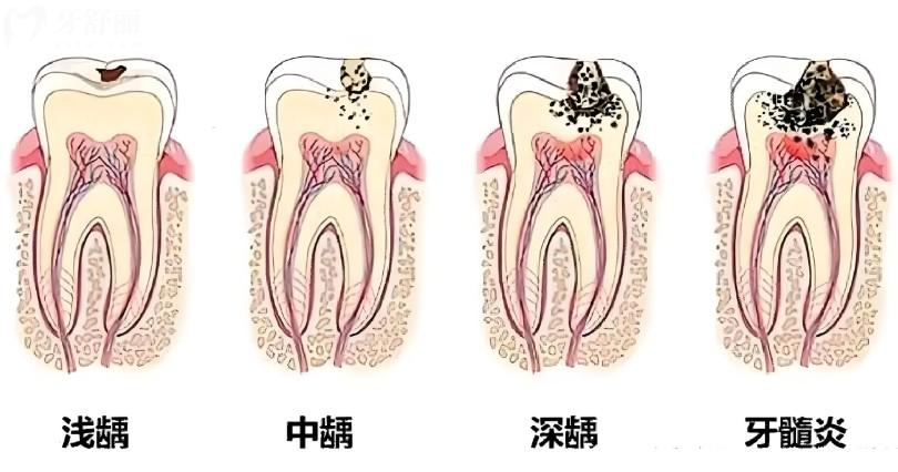 2026余姚口腔医院收费价目表全解析:名仕/三禾/冠杨口腔看牙性价比高 2026余姚口腔医院收费价目表全解析:名仕/三禾/冠杨口腔看牙性价比高