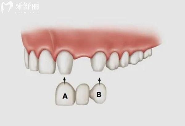 惠州致美口腔2026收费标准(二级医院)韩系种植牙2680+ 惠州致美口腔2026收费标准(二级医院)韩系种植牙2680+