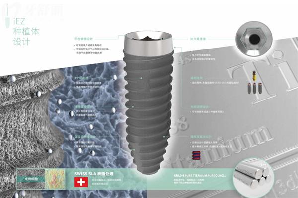 种植牙选国产的还是进口的好?对比种植牙品牌材质/使用性能/价格标准等可知 种植牙选国产的还是进口的好?对比种植牙品牌材质/使用性能/价格标准等可知