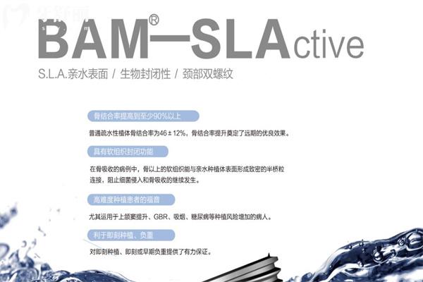 种植牙选国产的还是进口的好?对比种植牙品牌材质/使用性能/价格标准等可知 种植牙选国产的还是进口的好?对比种植牙品牌材质/使用性能/价格标准等可知