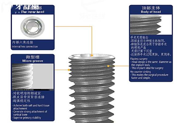 种植牙选国产的还是进口的好?对比种植牙品牌材质/使用性能/价格标准等可知 种植牙选国产的还是进口的好?对比种植牙品牌材质/使用性能/价格标准等可知