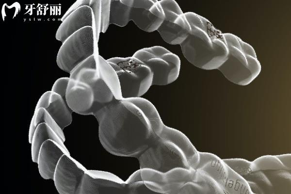 时代天使隐形矫正有哪些系列 时代天使隐形矫正有哪些系列