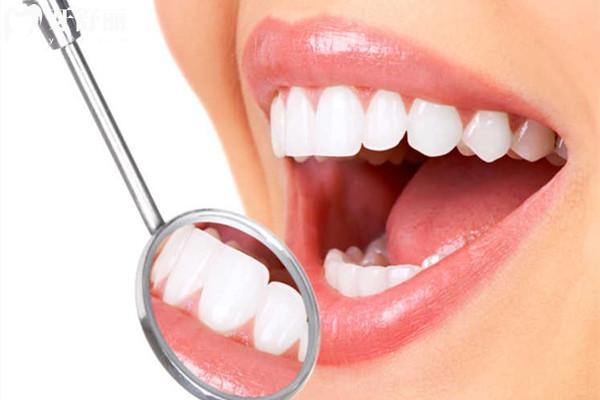 牙龈切除术收费标准 牙龈切除术收费标准