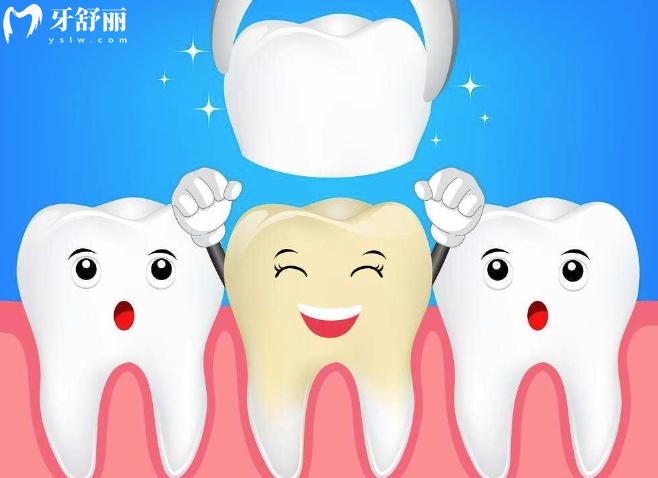 揭晓美国拉瓦全瓷牙怎么样?一般多少钱? 揭晓美国拉瓦全瓷牙怎么样?一般多少钱?