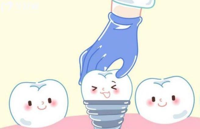 60岁老人掉牙是什么原因?应该怎么处理,是种植牙还是镶牙 60岁老人掉牙是什么原因?应该怎么处理,是种植牙还是镶牙