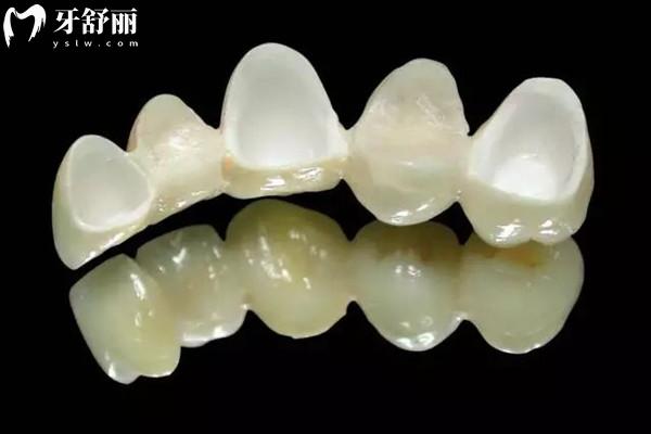 天牙口腔医院收费标准 天牙口腔医院收费标准