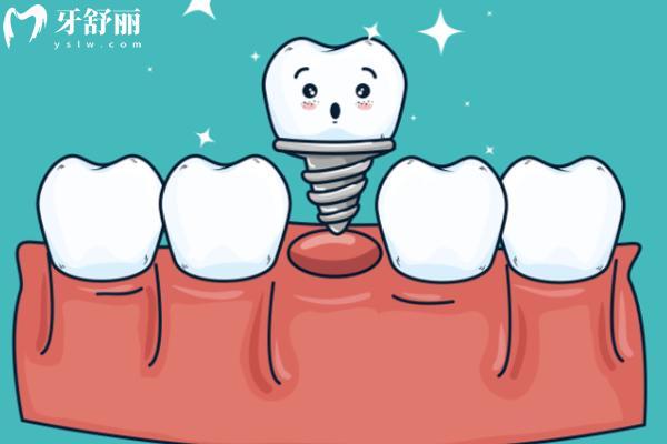 南昌看牙哪家便宜又好 南昌看牙哪家便宜又好