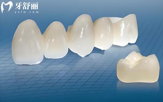 【2026珠海牙科收费标准全指南】从种植牙到儿牙治疗9大项目价目表深度解析 【2026珠海牙科收费标准全指南】从种植牙到儿牙治疗9大项目价目表深度解析